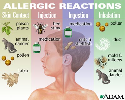 allergy chart